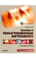 Essentials of Clinical Periodontology and Periodontics