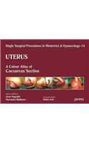 Single Surgical Procedures in Obstetrics and Gynaecology - Volume 14 - Uterus