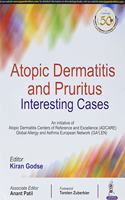 Atopic Dermatitis and Pruritus