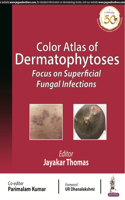 Color Atlas of Fungal Infections: Focus on Superficial Fungal Infections