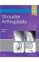 Shoulder Arthroplasty