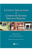 Clinical Application of Computer-Guided Implant Surgery