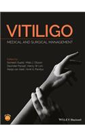 Vitiligo