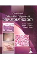 Color Atlas of Differential Diagnosis in Dermatopathology