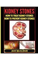 Kidney Stones