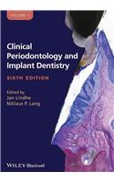 Clinical Periodontology and Implant Dentistry, 2 Volume Set