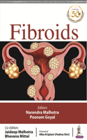 Fibroids