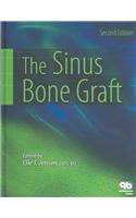 Sinus Bone Graft