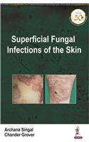 Superficial Fungal Infections of The Skin