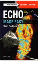 Echo Made Easy