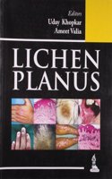 LICHEN PLANUS