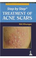 Step by Step: Treatment of Acne Scars