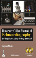 Illustrative Video Manual of Echocardiography for Beginners