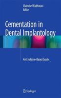 Cementation in Dental Implantology