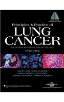 Principles & Practice of Lung Cancer: The Official Reference Text of the IASLC