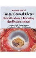 Aravind's Atlas of Fungal Corneal Ulcers