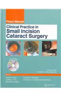 Clinical Practice in Small Incision Cataract Surgery