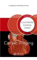 Cardiac Imaging