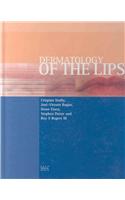 Dermatology of the Lips