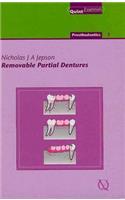 Removable Partial Dentures