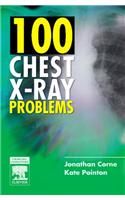 100 Chest X-Ray Problems