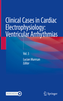 Clinical Cases in Cardiac Electrophysiology: Ventricular Arrhythmias