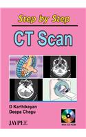 Step by Step CT Scan