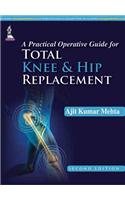 Practical Operative Guide for Total Knee and Hip Replacement