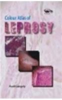 Colour Atlas Of Leprosy