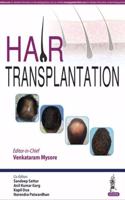 Hair Transplantation