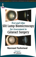 Text and Atlas: Slit Lamp Biomicroscopy for Assessment in Cataract Surgery