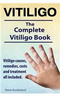 Vitiligo. Vitiligo causes, remedies, costs and treatment all included. The complete Vitiligo Book.