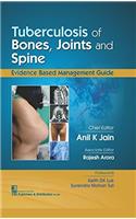 Tubercolosis of Bones, Joints and Spine