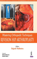 Mastering Orthopedic Techniques: Revision Total Hip Arthroplasty