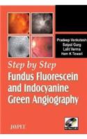 Step by Step Fundus Fluorescein and Indocyanine Green Angiography Wiht Photo CD-Rom,2007