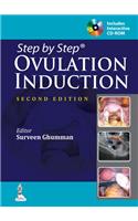 Ovulation Induction