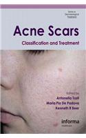 Acne Scars