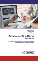 Advancements in Dental Implants