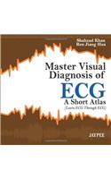 Master Visual Diagnosis of Ecg: A Short Atlas (Learn ECG Through Ecg)