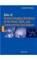 Atlas of Normal Imaging Variations of the Brain, Skull, and Craniocervical Vasculature