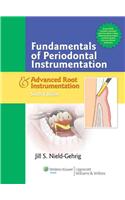 Fundamentals of Periodontal Instrumentation and Advanced Root Instrumentation