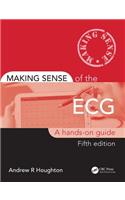 Making Sense of the ECG