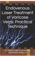 Endovenous Laser Treatment of Varicose Veins