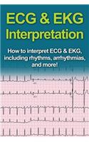 ECG & EKG Interpretation